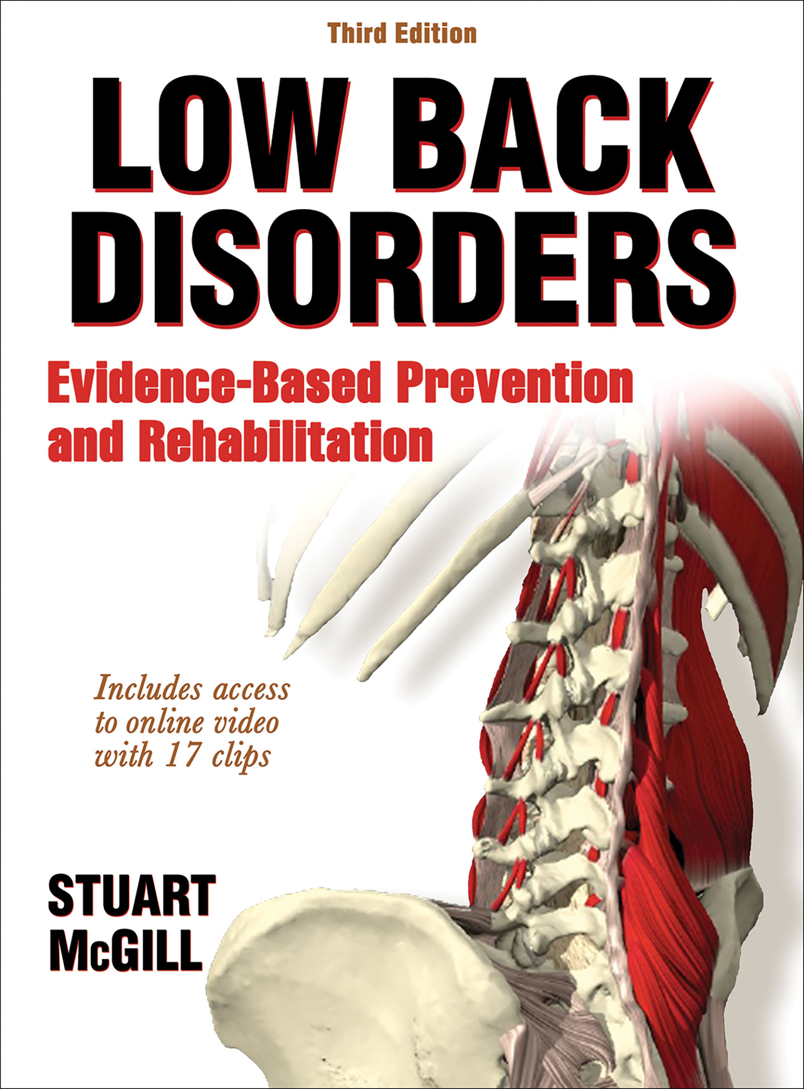 Low Back Disorders